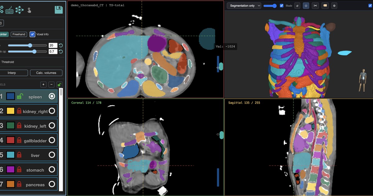 MedSeg showing a DICOM-derived CT series and segmentation masks.