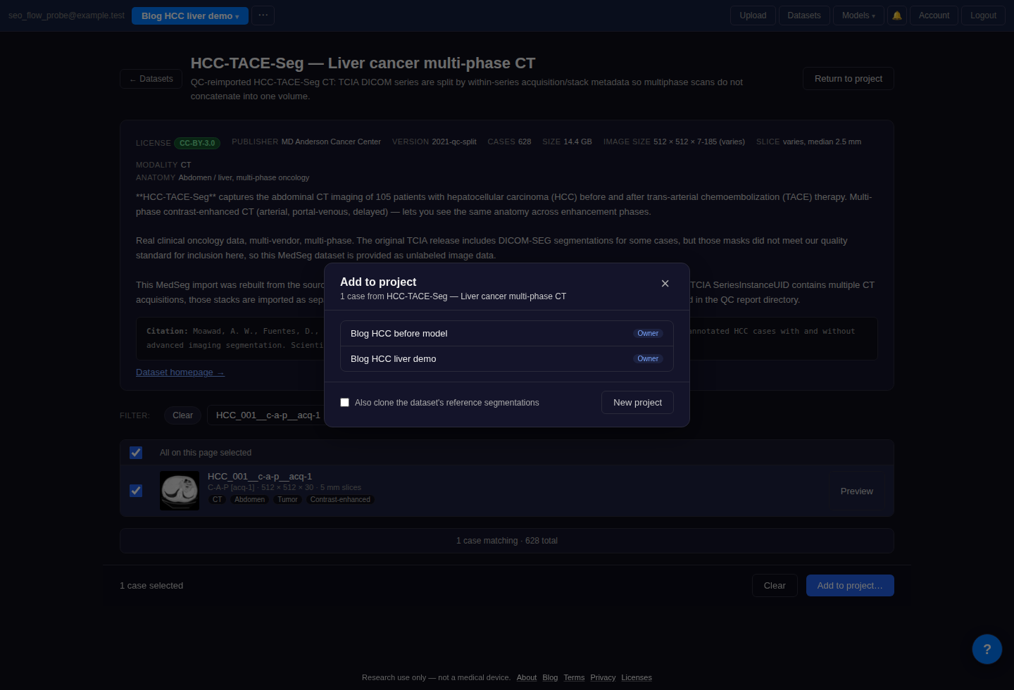 Add to project dialog with the HCC case selected and reference segmentations unchecked.