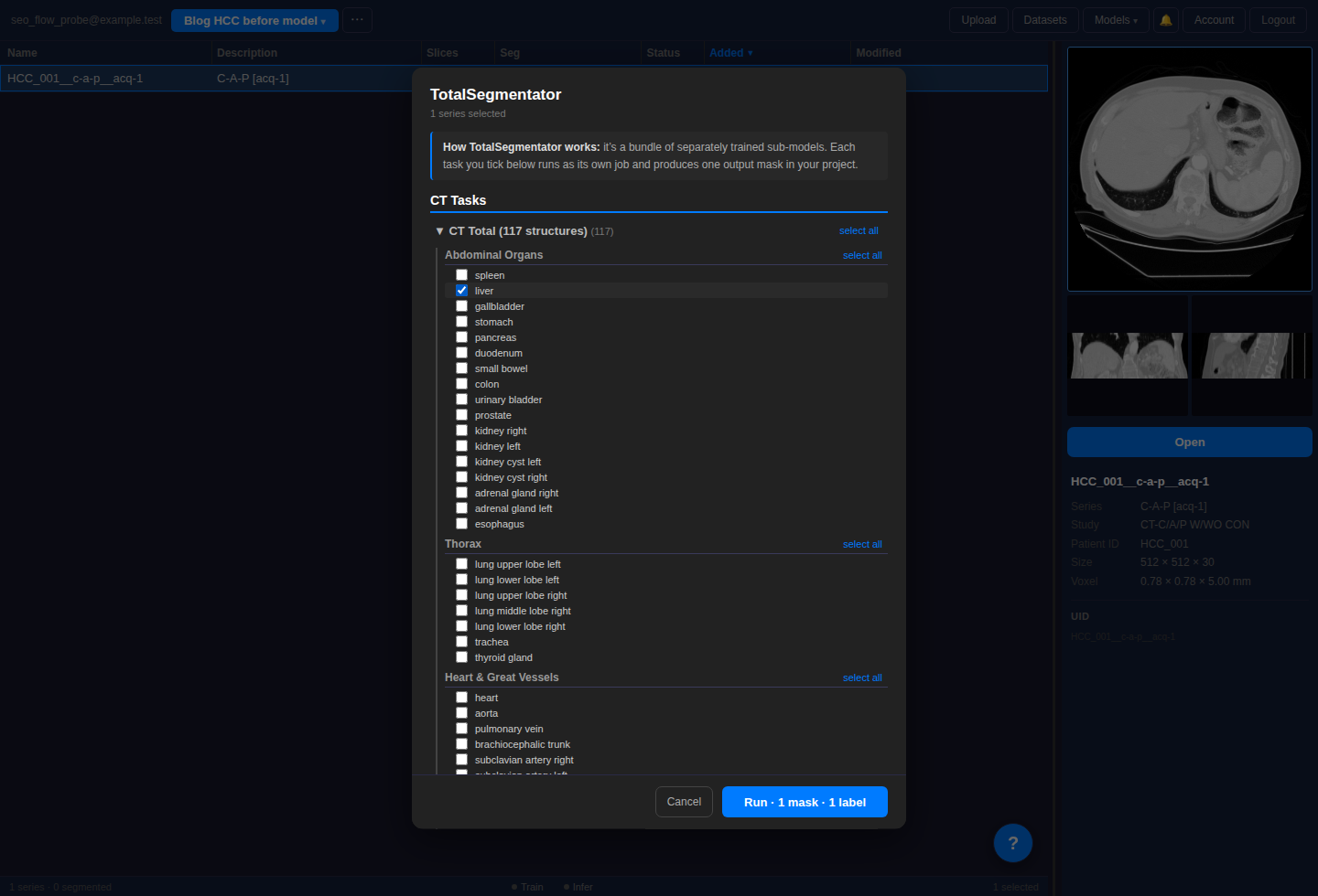 TotalSegmentator modal with CT Total expanded and only the liver label selected.