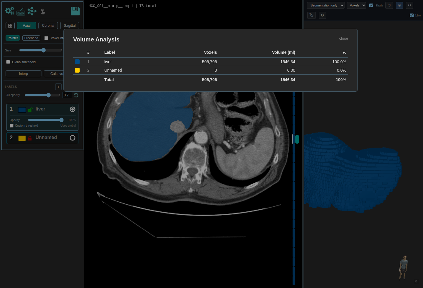 Volume analysis modal showing liver voxels and volume for the TotalSegmentator output.