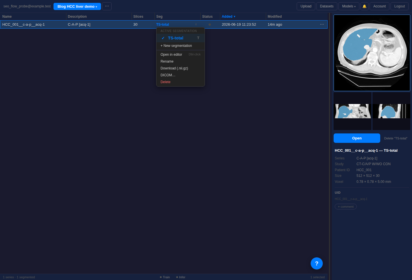MedSeg segmentation menu showing Download .nii.gz and DICOM export options.