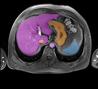 amos_0507 - AMOS22 - Abdominal Multi-Organ case preview