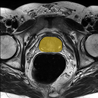 Medical Decathlon - PROSTATE preview