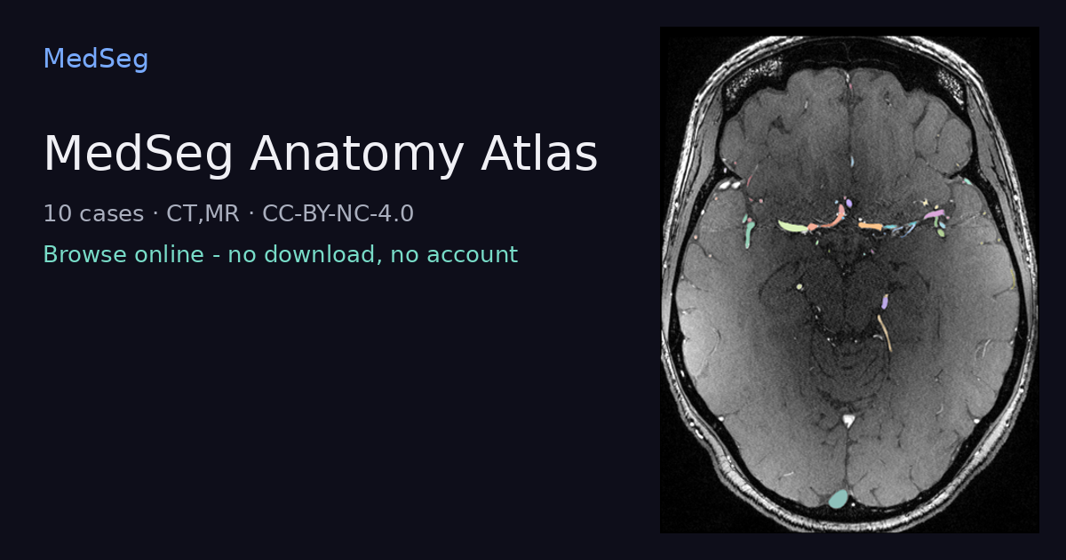 MedSeg Anatomy Atlas - example case rendered in the MedSeg editor