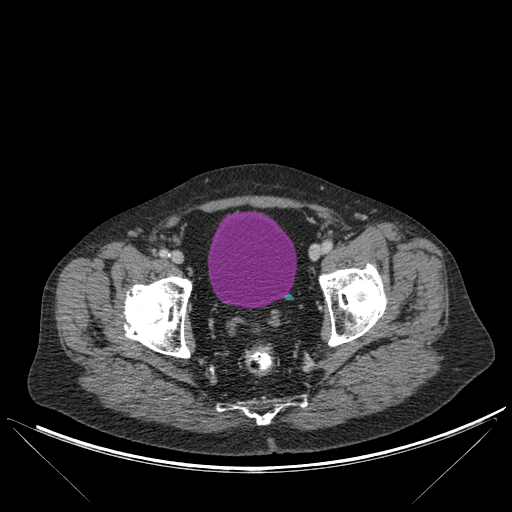 urinary-system - MedSeg Anatomy Atlas case preview