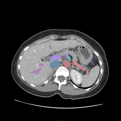 vasculature-of-the-abdomen - MedSeg Anatomy Atlas case preview