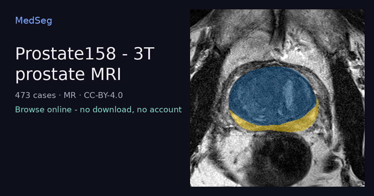 Prostate158 - 3T prostate MRI - example case rendered in the MedSeg editor