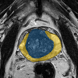 train-021-t2 - Prostate158 - 3T prostate MRI case preview