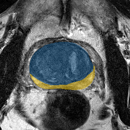 Prostate158 - 3T prostate MRI preview