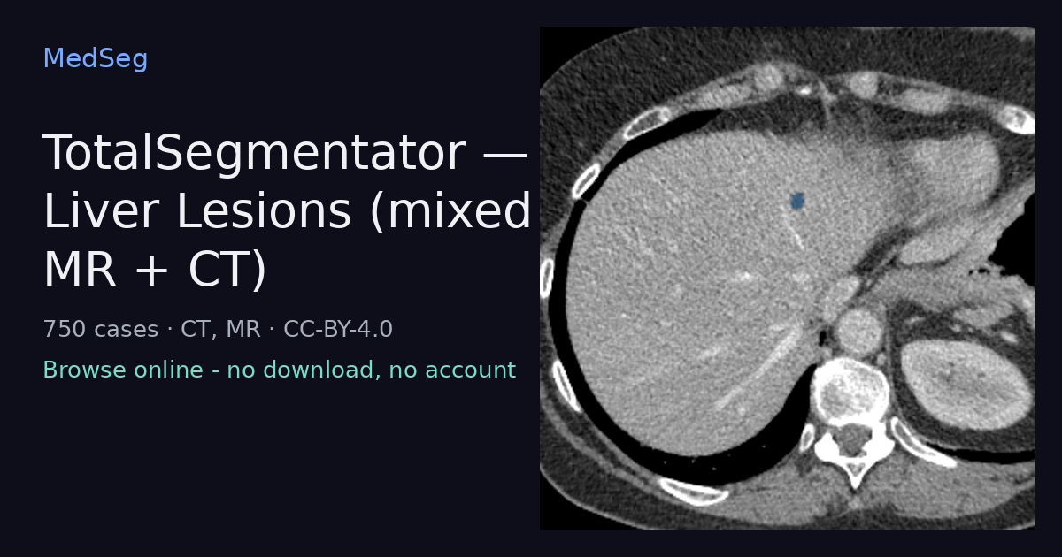 TotalSegmentator - Liver Lesions (mixed MR + CT) - example case rendered in the MedSeg editor