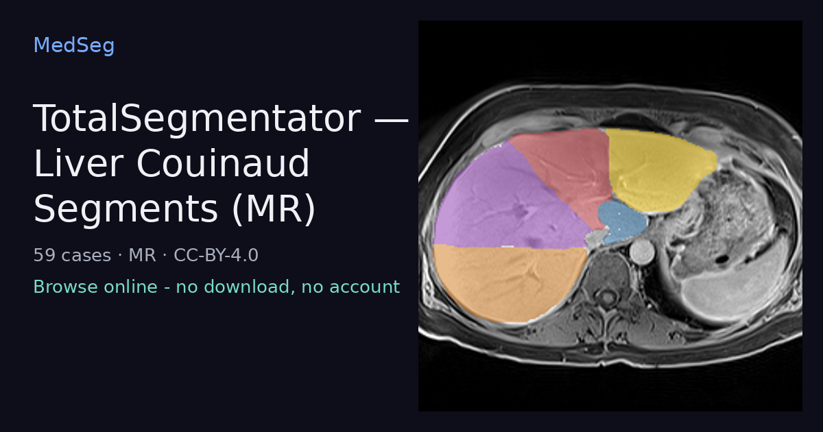 TotalSegmentator - Liver Couinaud Segments (MR) - example case rendered in the MedSeg editor